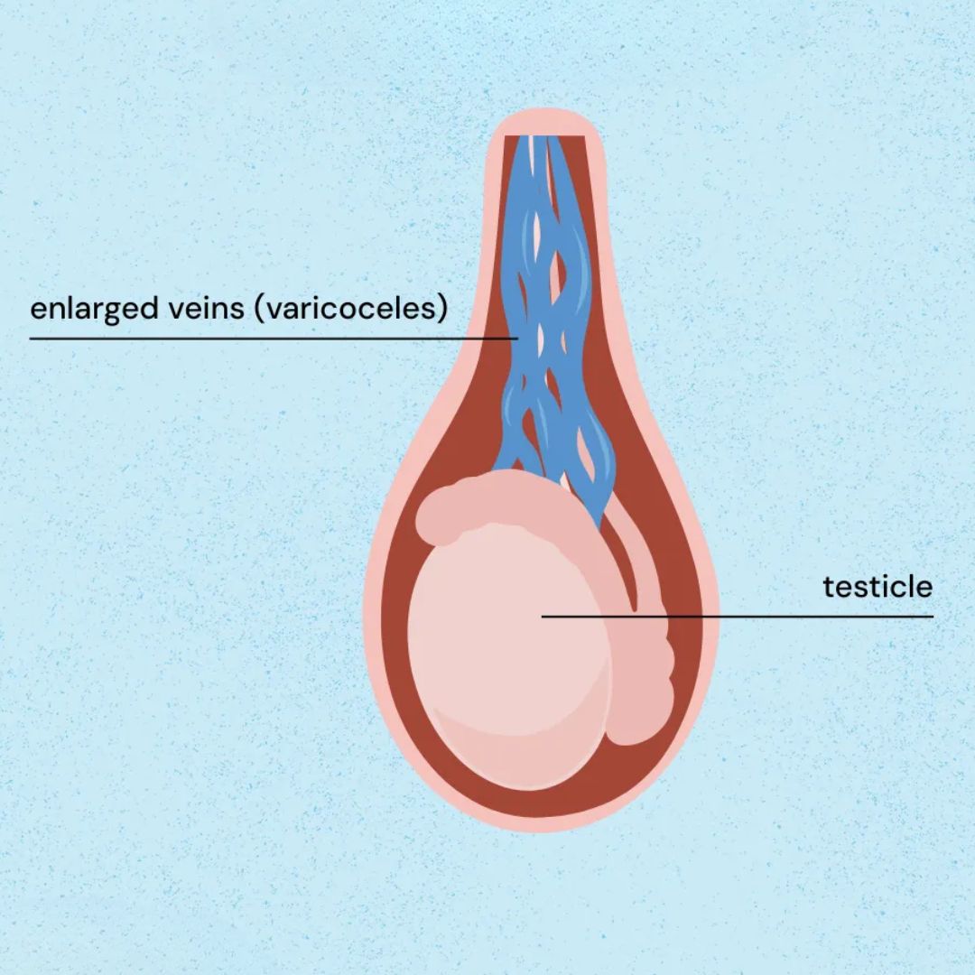 male reproductive health problems in india