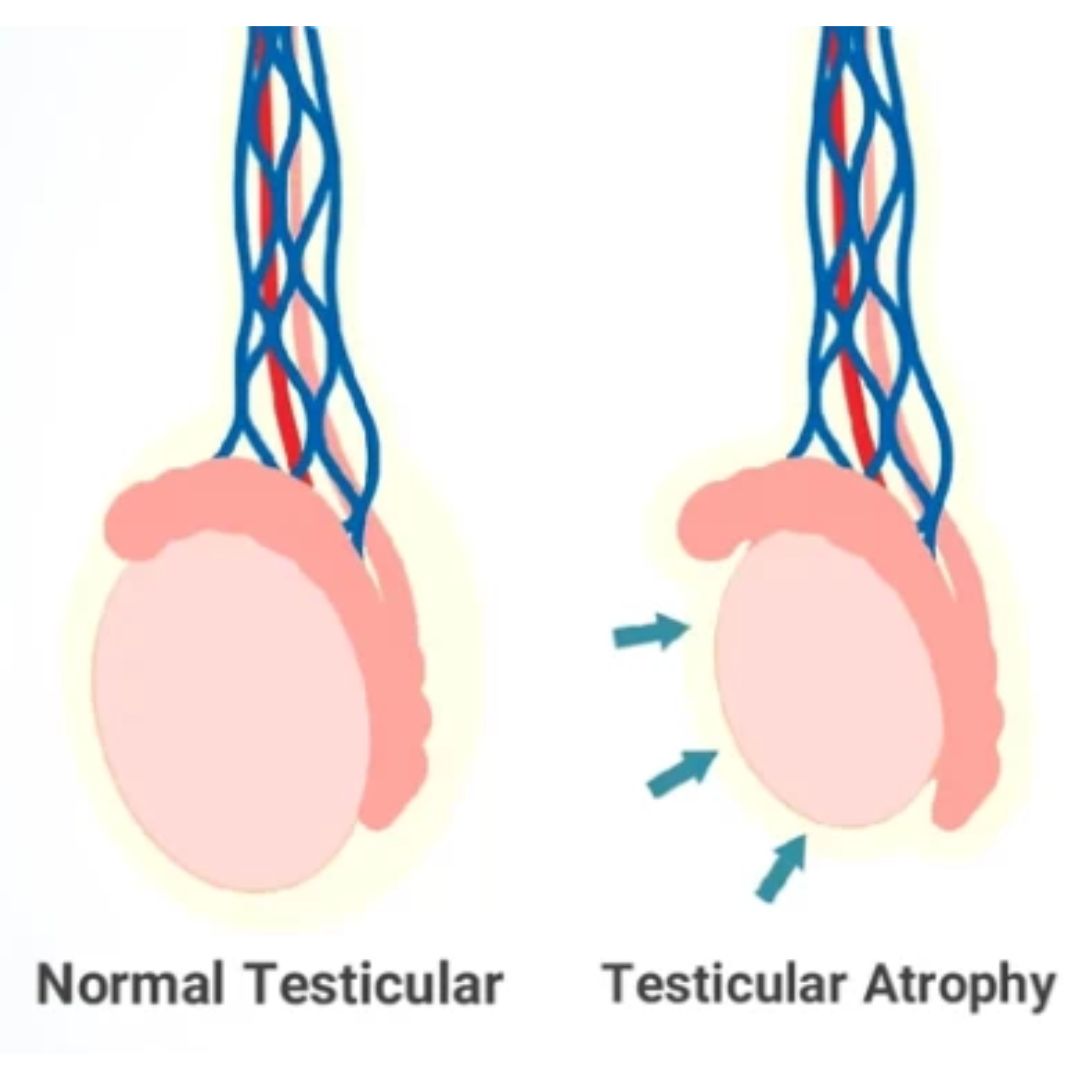 Low Cost Infertility Treatment