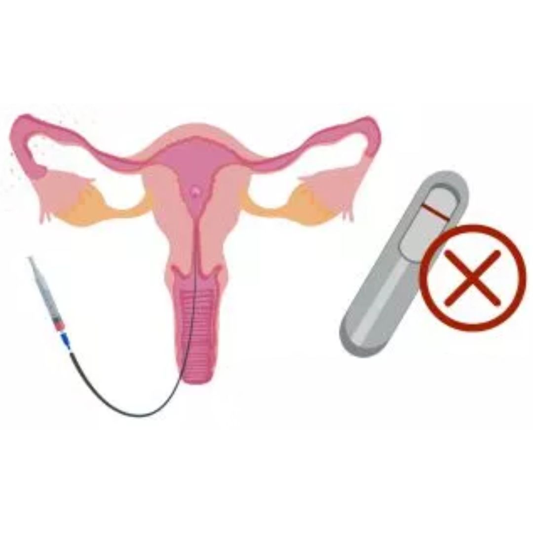 Infertility treatment