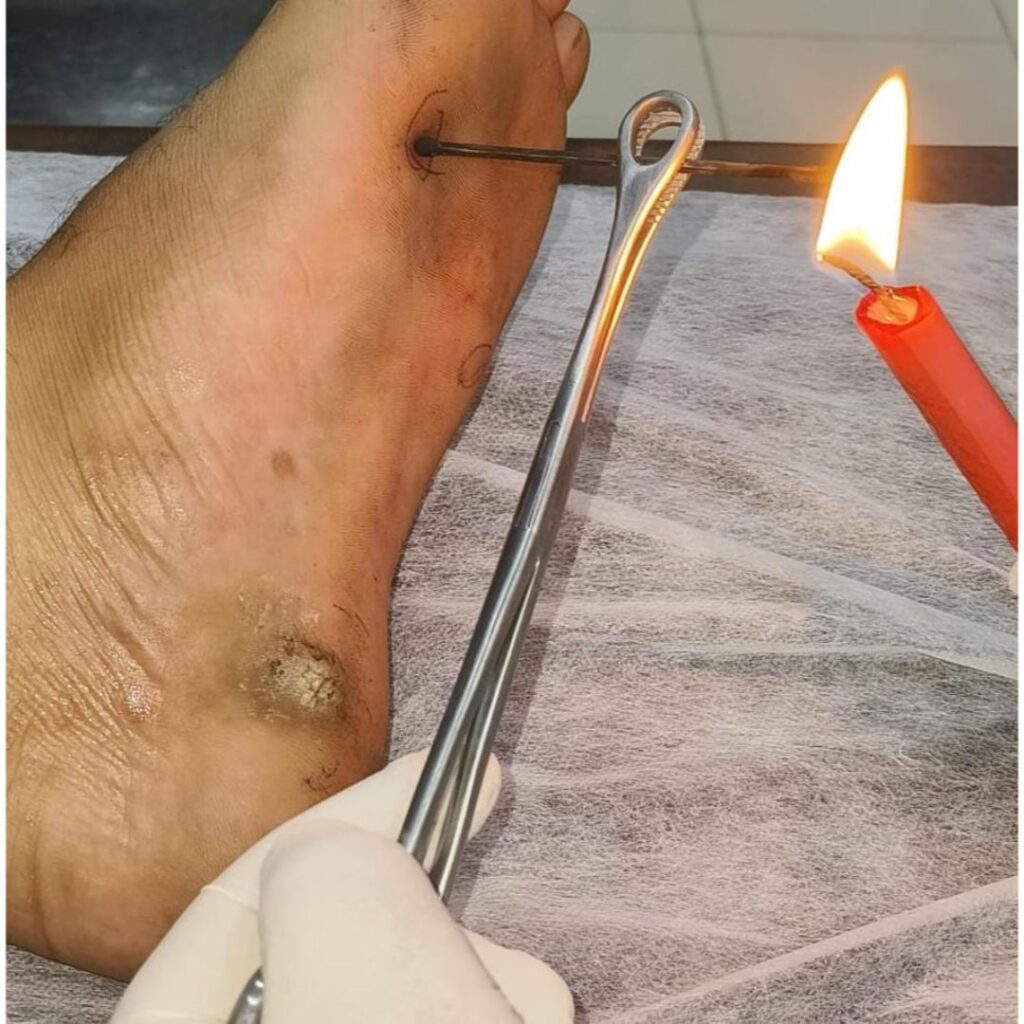 Best Ayurvedic treatment for overall health