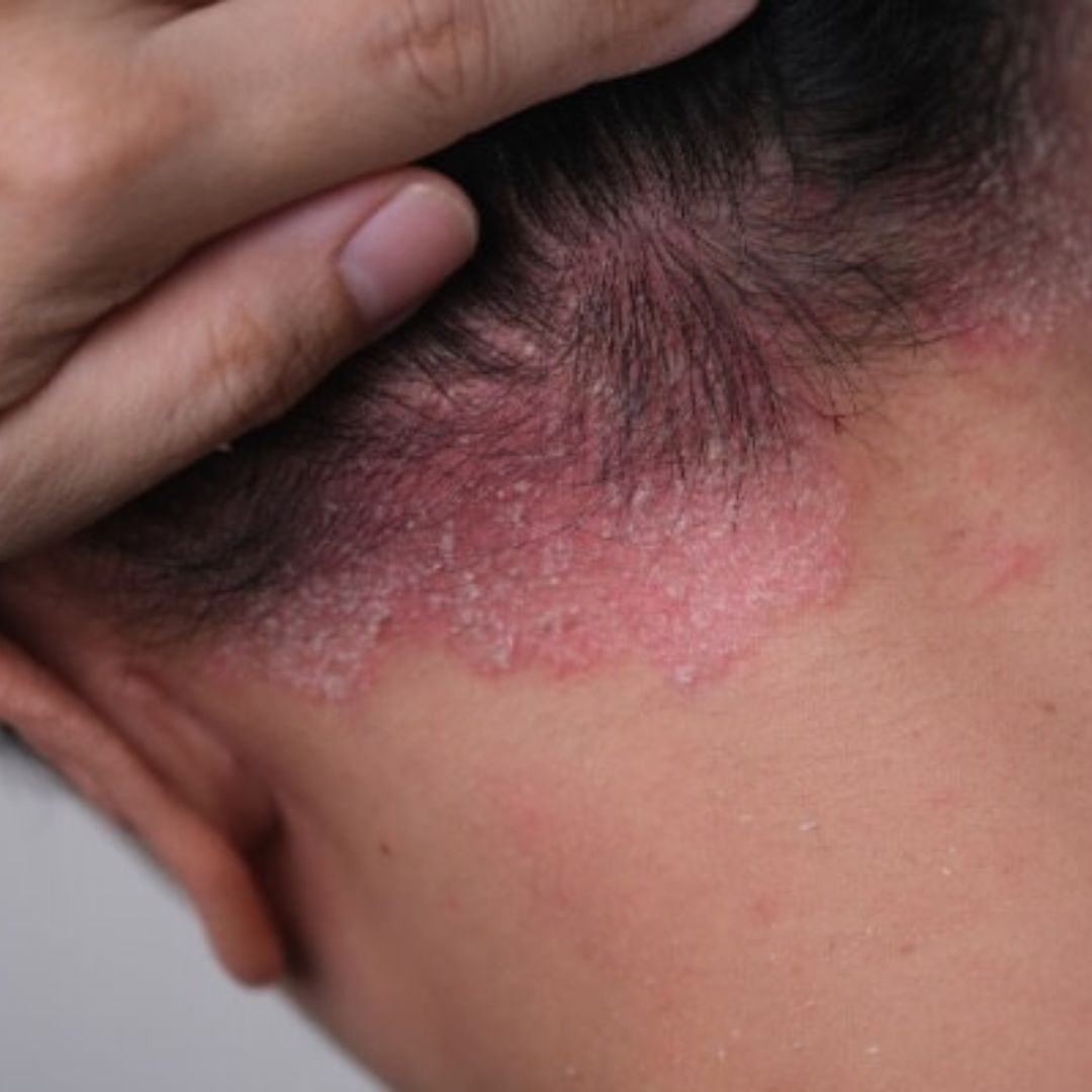 affordable ayurvedic treatment in india