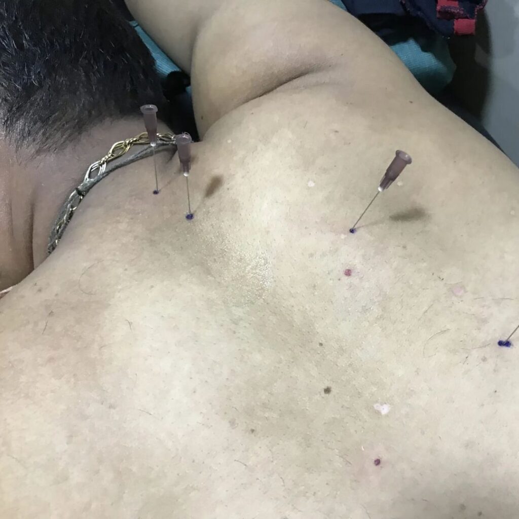 Online Consultation with Ayurveda Doctors