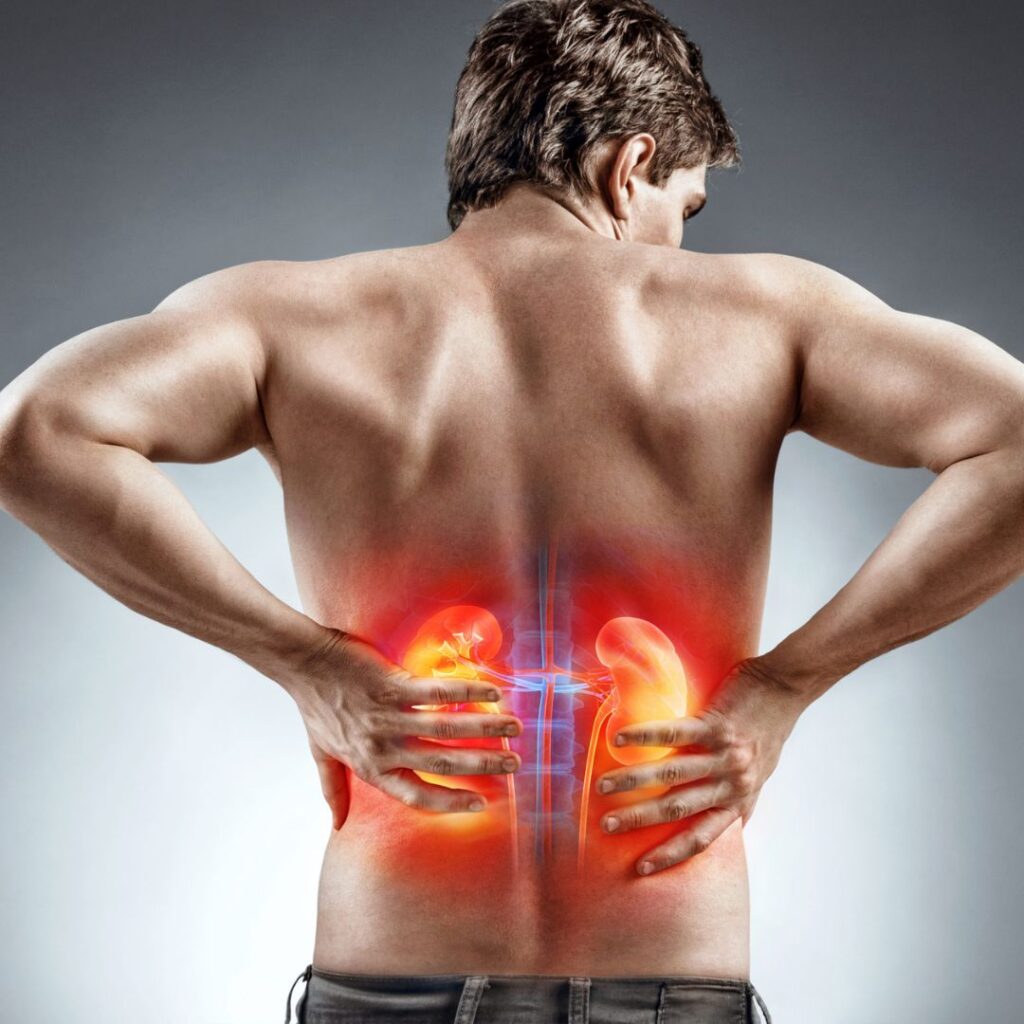Back pain indicating kidney infections affecting kidney health