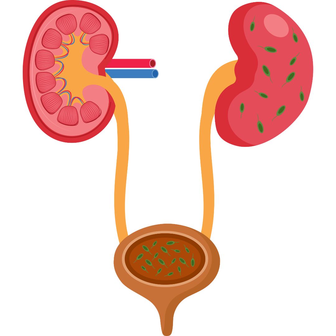 Bacterial infection causing urinary tract infections and urinary bladder problems
