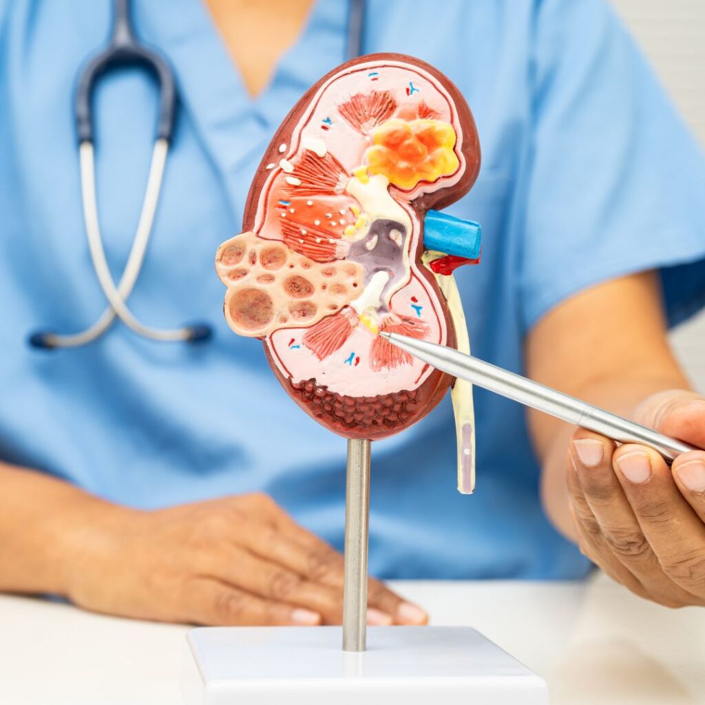 Chronic kidney disease managed through ayurvedic kidney disease treatment