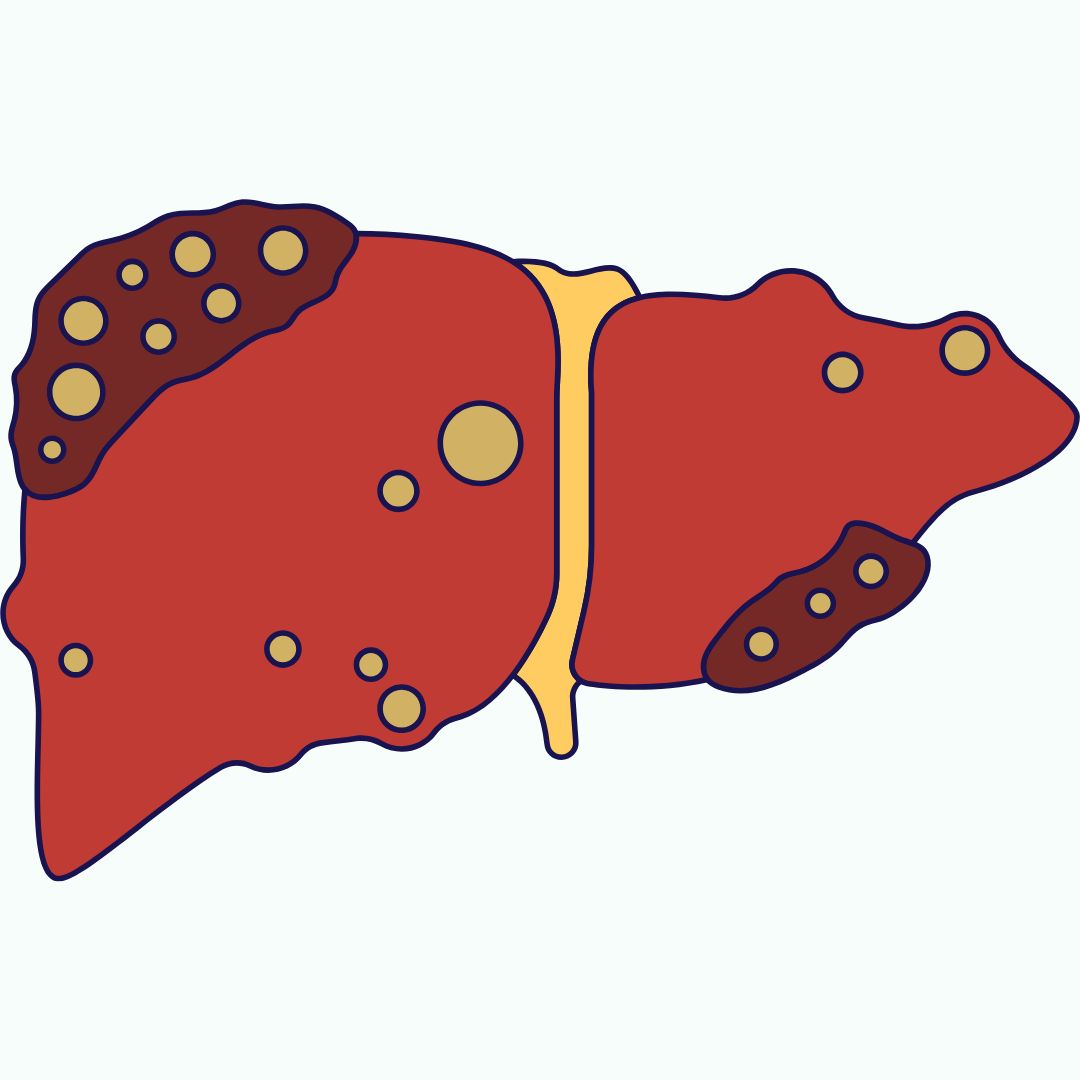 Chronic liver damage