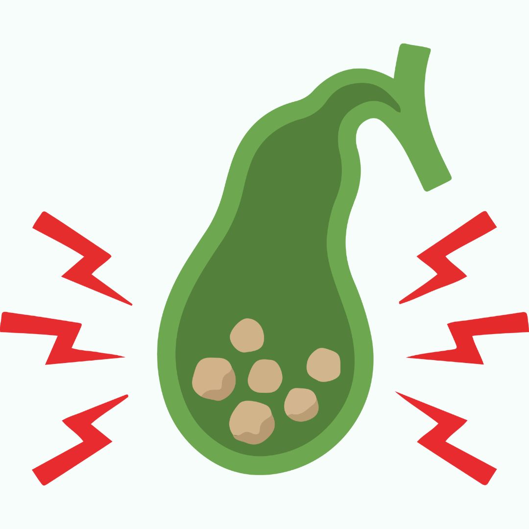 Gallstones and biliary obstruction
